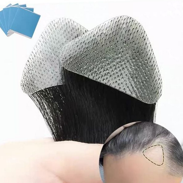 초경량 붙임머리 가발 앞머리 헤어라인 가발 정수리 증모 - 메인 이미지