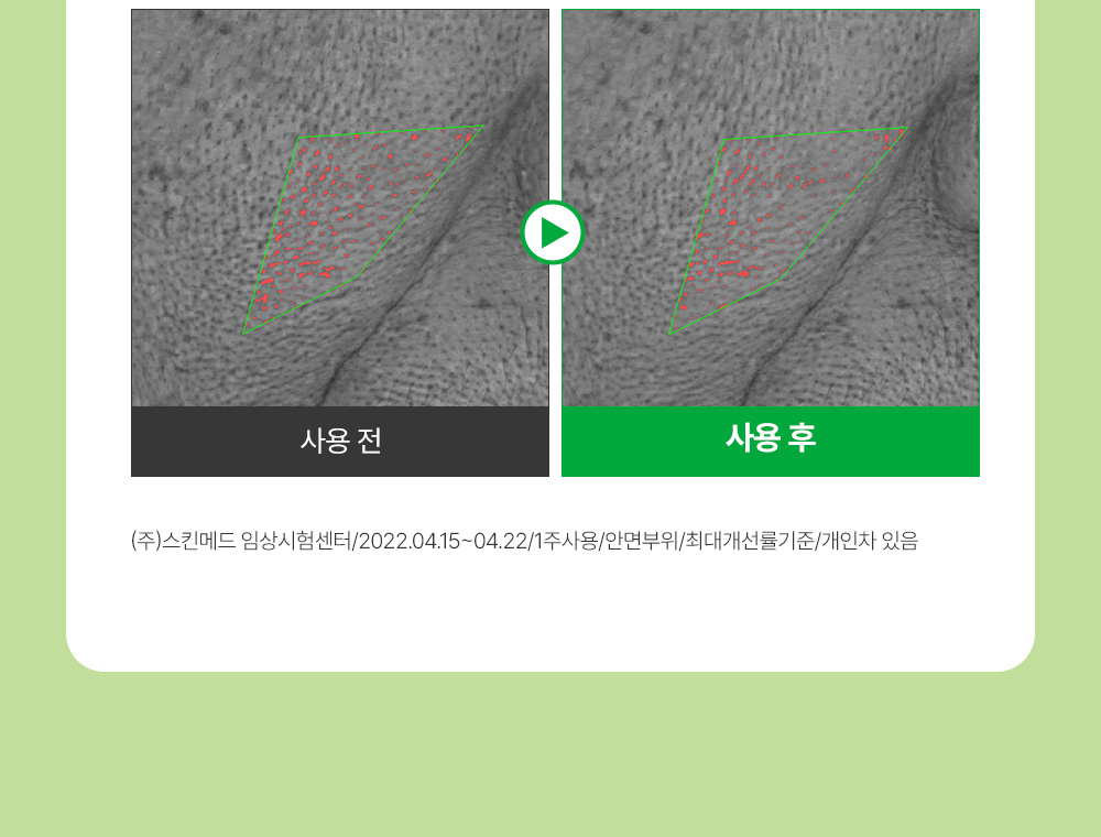 sungboon editor green tomato concentrated ampoule