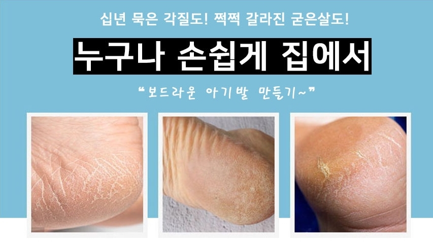 프리미엄 글라스 발각질제거 각질제거기 제거 발뒤꿈치 발바닥 풋패치 굳은살 이미지 6