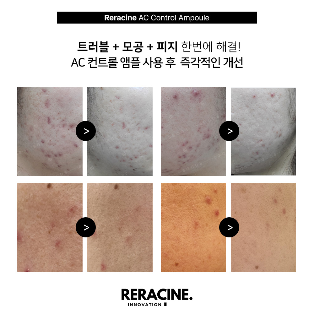 리라신 AC컨트롤 앰플 트러블 - 상세 이미지 2