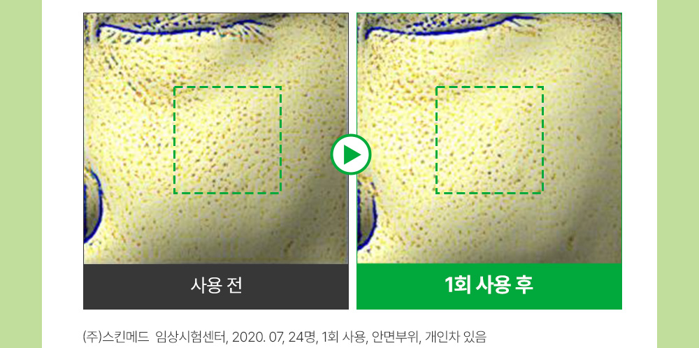 sungboon editor green tomato concentrated ampoule