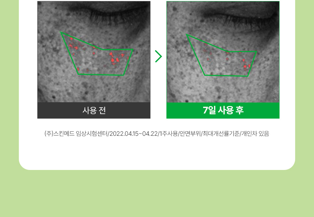sungboon editor green tomato concentrated ampoule