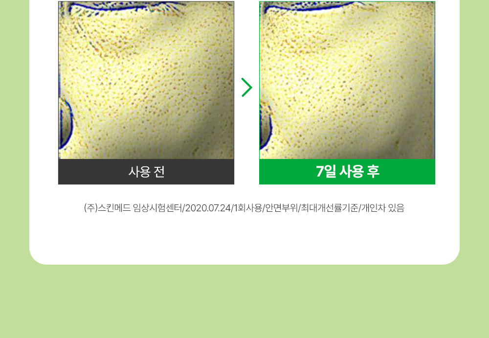 sungboon editor green tomato concentrated ampoule