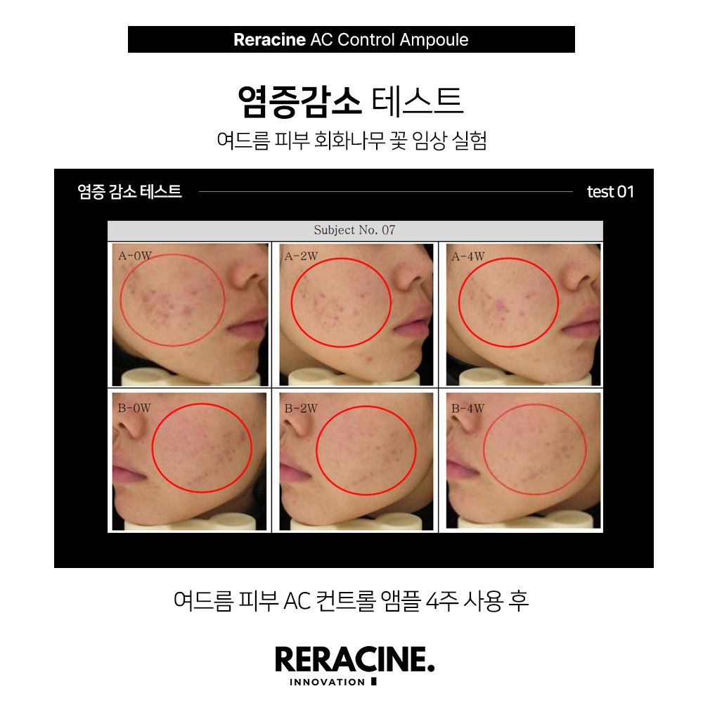 리라신 AC컨트롤 앰플 트러블 이미지 6
