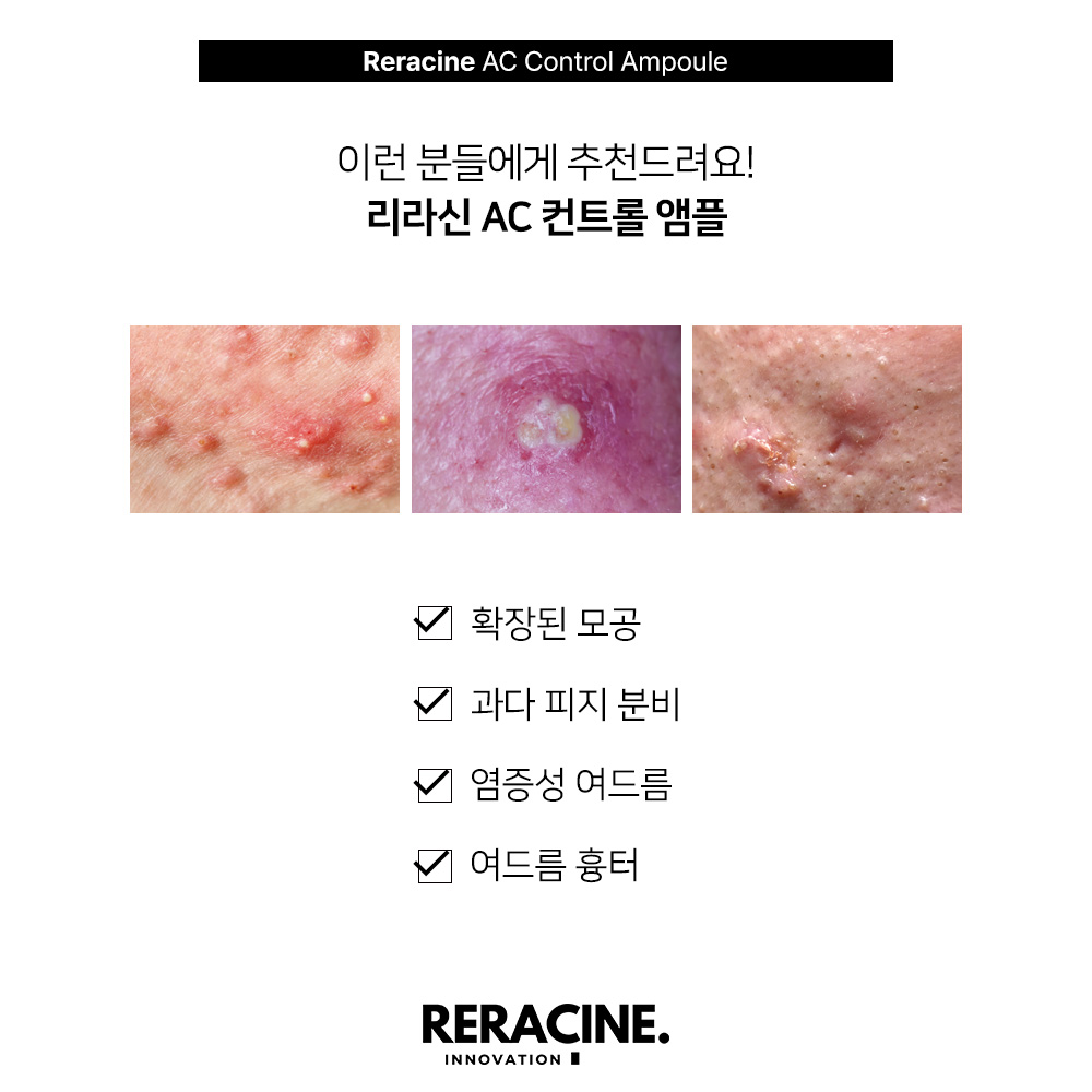 리라신 AC컨트롤 앰플 트러블 - 상세 이미지 5