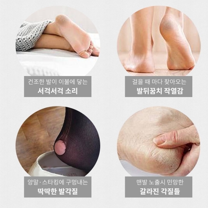 프리미엄 글라스 발각질제거 각질제거기 제거 발뒤꿈치 발바닥 풋패치 굳은살 - 상세 이미지 4