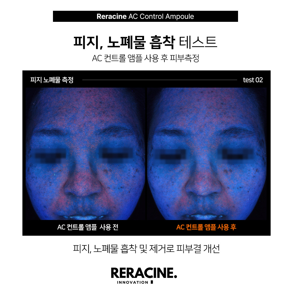 리라신 AC컨트롤 앰플 트러블 이미지 7
