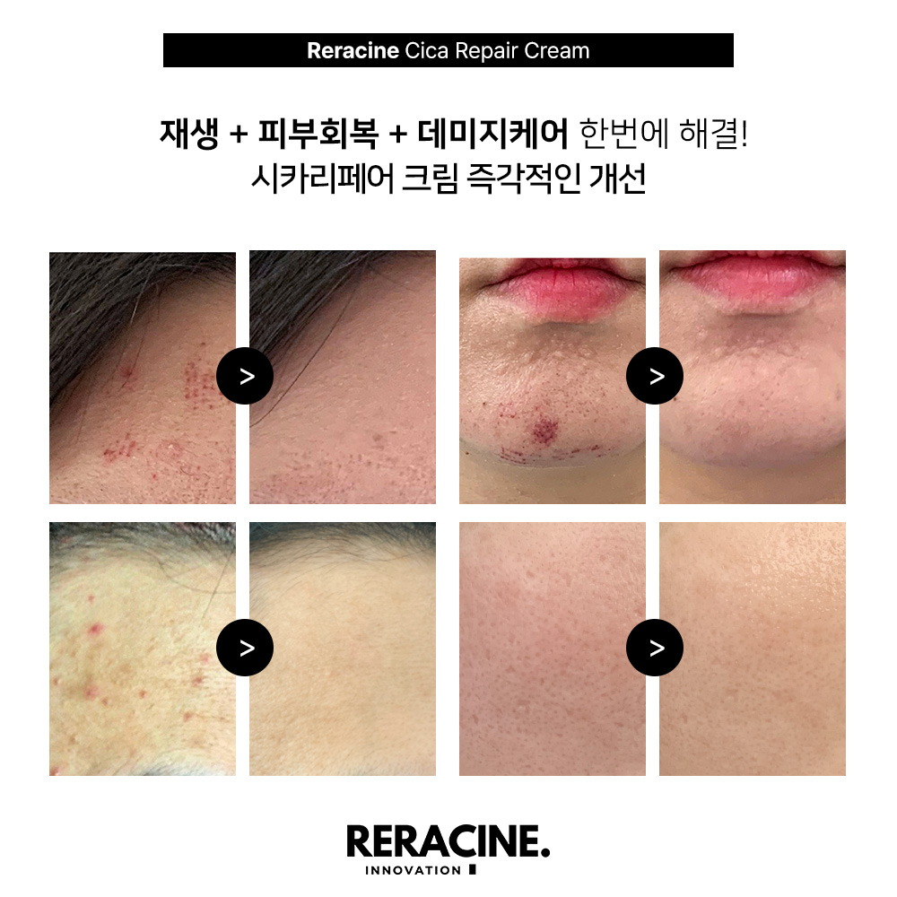 리라신 시카리페어크림 80g 진정+장벽 - 상세 이미지 2