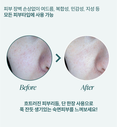 에크리크 라멜타 시트1박스 10회분 - 상세 이미지 3