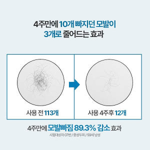 [남자샴푸] 쏘펠 블로커12 남성 탈모샴푸 쏘팔메토 맥주효모 카페인 비오... 솔직 후기 | 피부 타입별 분석 - 상품 이미지 4