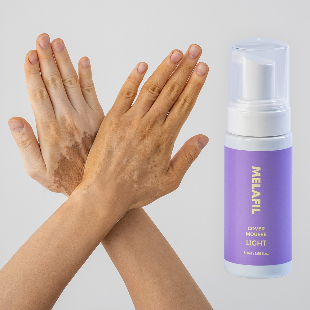 멜라필 무스 커버 백반증 커버제 컨실러 바디 넓은부위 워터프루프 50ml - 상품 이미지