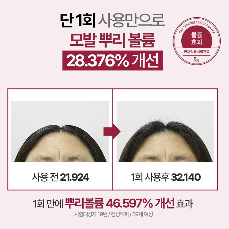 [여성탈모샴푸] 쏘펠 엑스퍼트12 여자 탈모샴푸 석류 콜라겐 약산성 큐티클 임산부탈모샴푸 500ml, 1개 - 상세 이미지 4