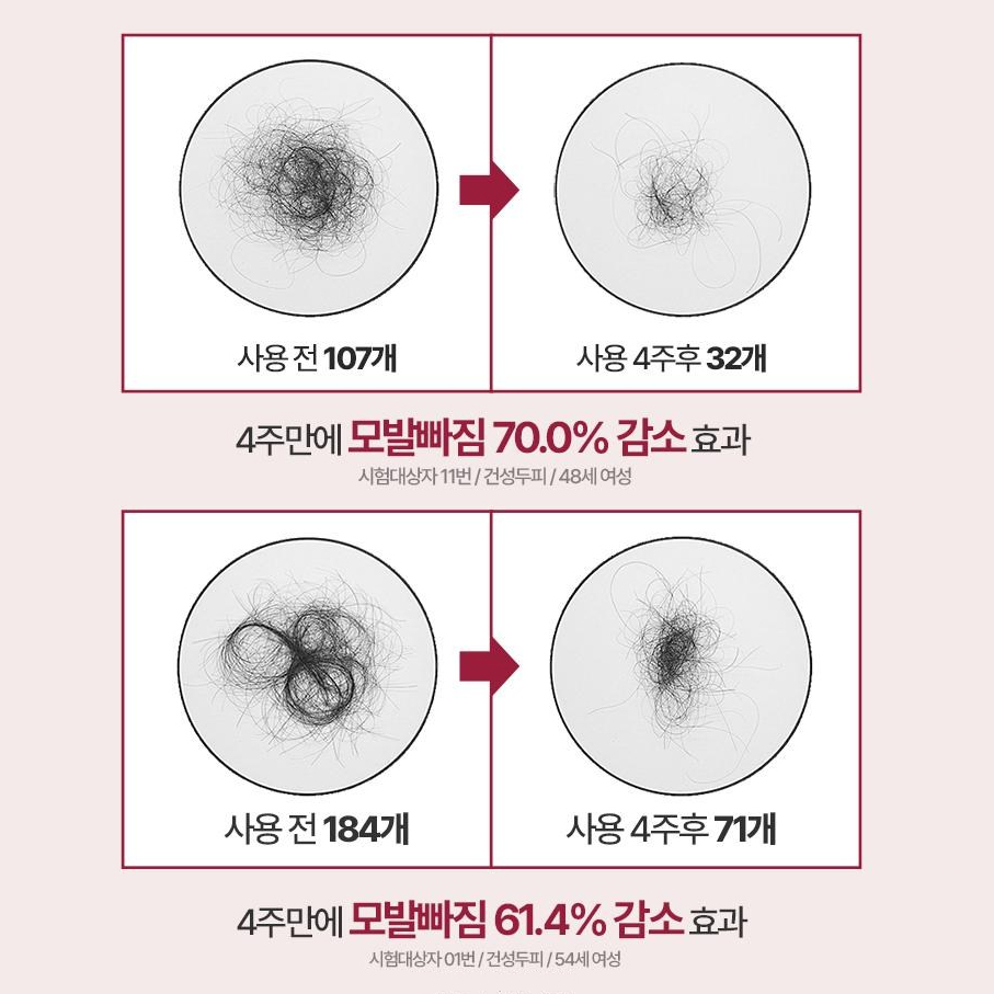 [여성탈모샴푸] 쏘펠 엑스퍼트12 여자 탈모샴푸 석류 콜라겐 약산성 큐티클 임산부탈모샴푸 500ml, 1개 - 상세 이미지 5