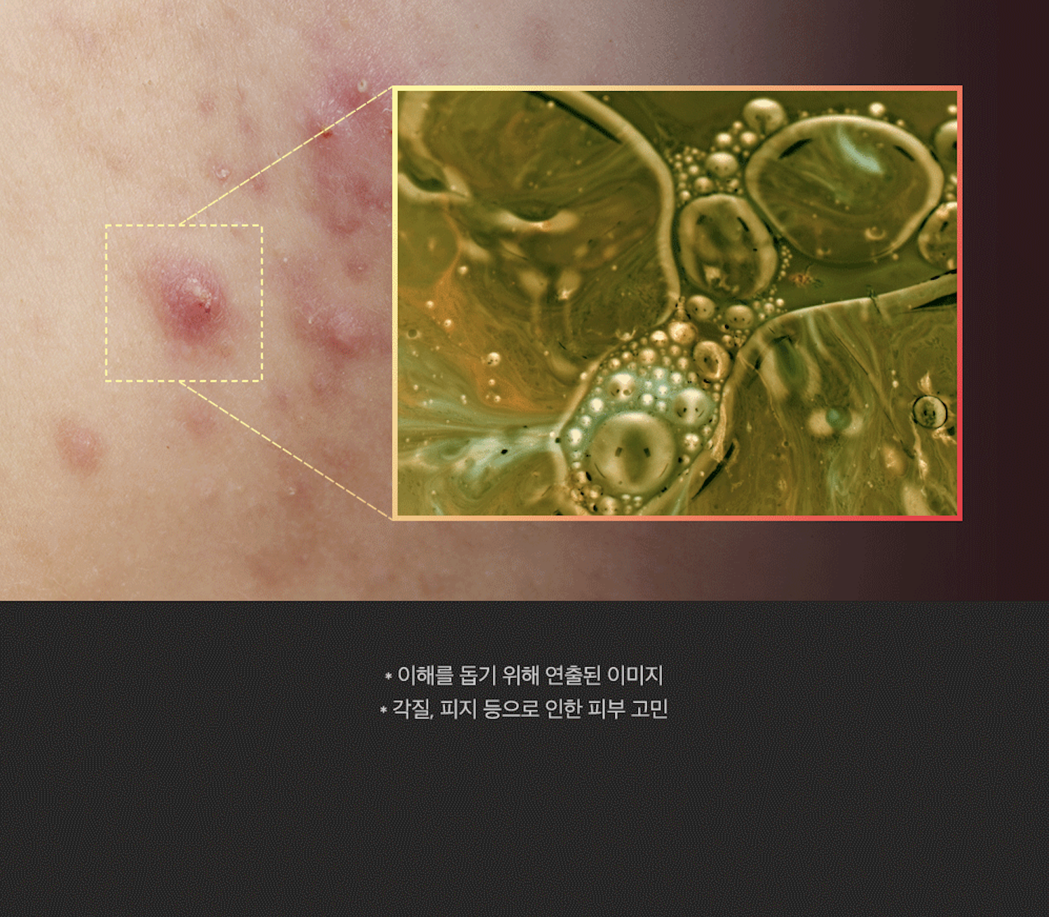 sungboon editor red houttuynia moisturizing cream