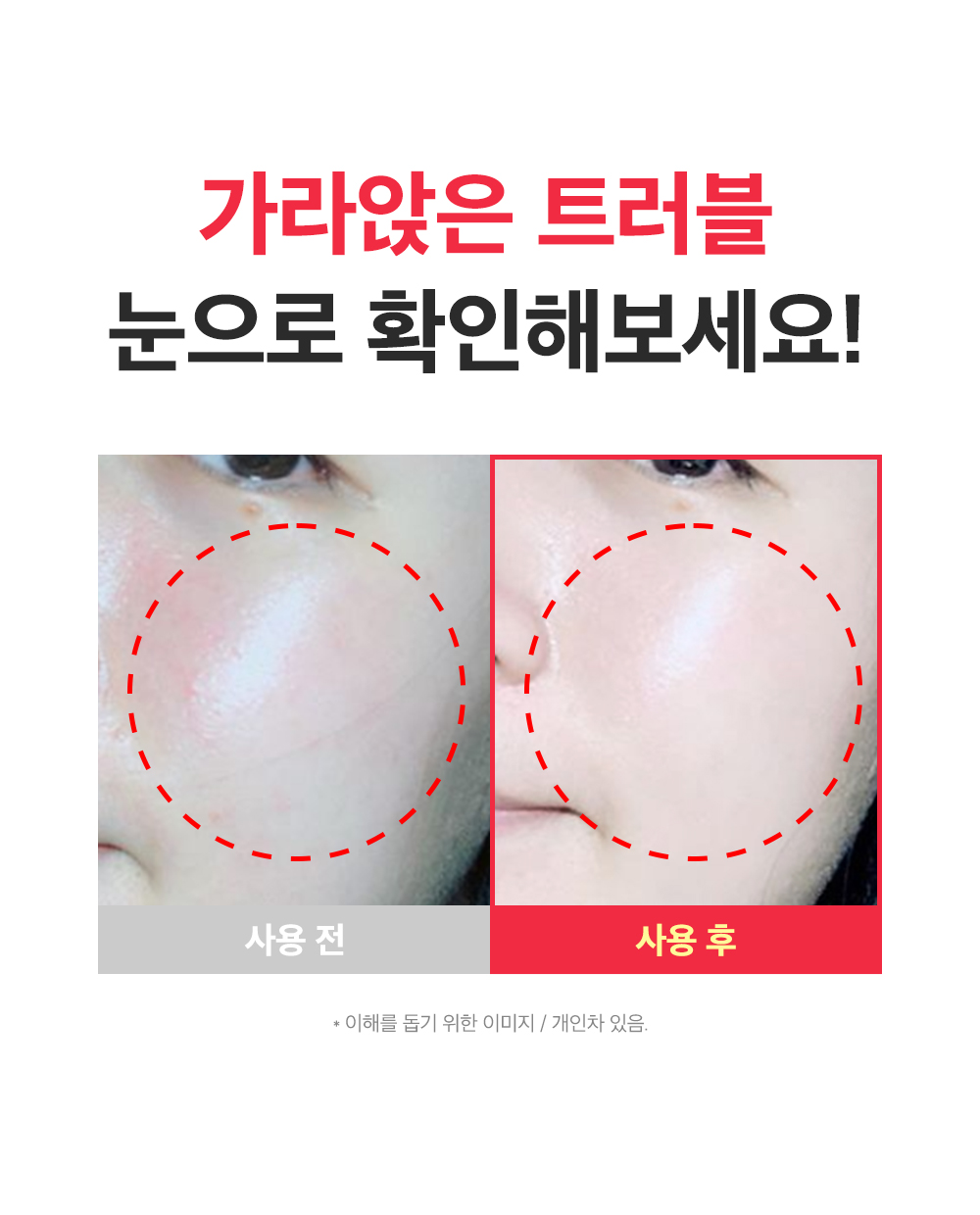 sungboon editor red houttuynia moisturizing cream