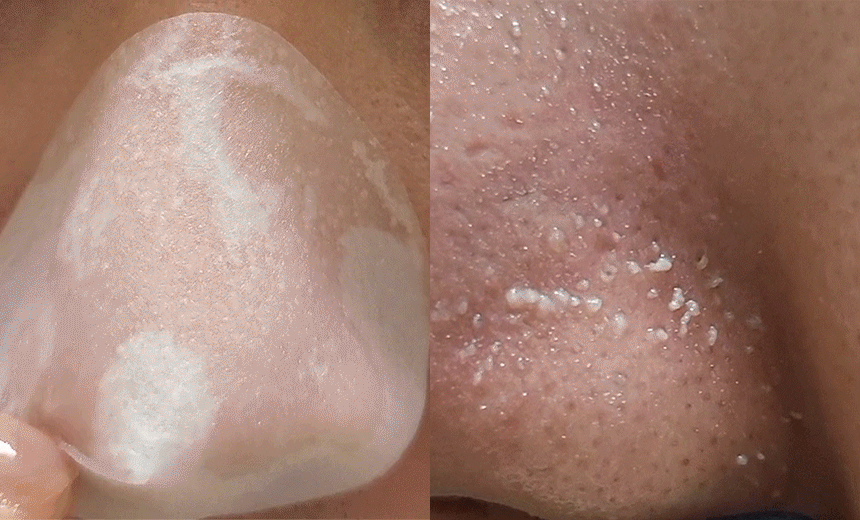 exfoliant chimique agent adoucissant sébum coréen