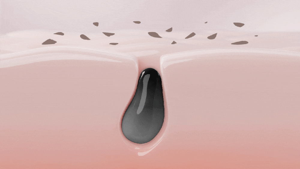 exfoliant chimique agent adoucissant sébum coréen