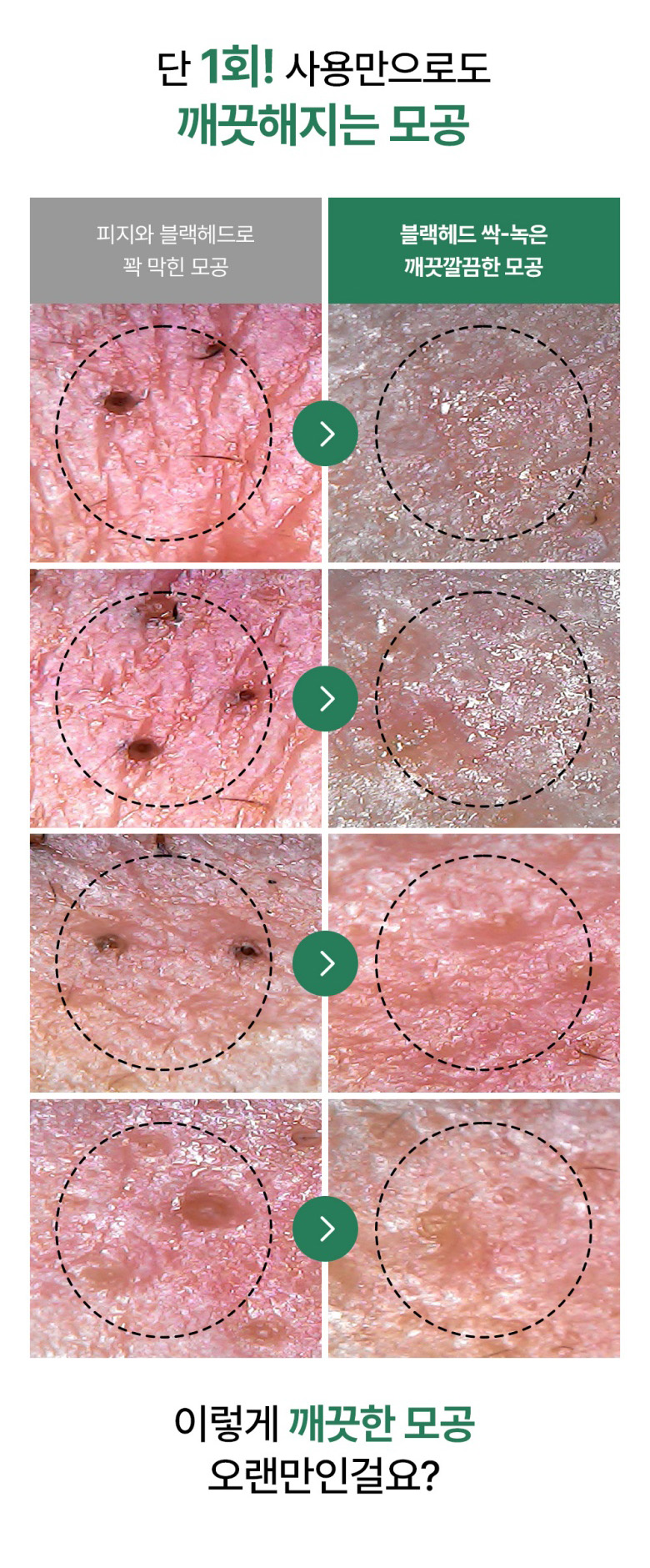 exfoliant chimique agent adoucissant sébum coréen