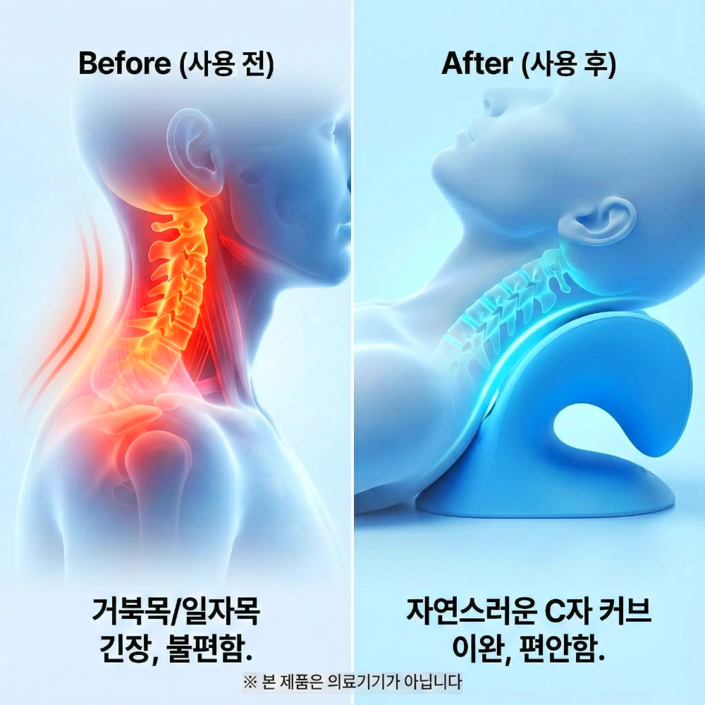 목 디스크 운동 기구 목 스트레칭 기구 거북목 체형 교정기 일자목 넥스트레쳐 - 상세 이미지 3