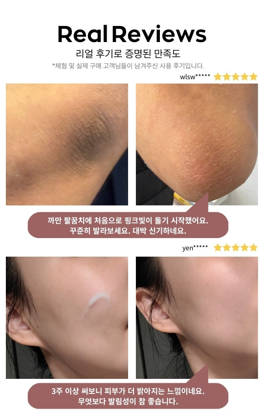 끌레브 착색크림 트라넥산삼 트라넥 미백 알부틴 색소침착크림 50ml, 2개 판매처 상세 정보 이미지 4