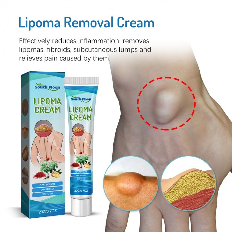 피지낭종 제거 연고 지방종 완화 표피낭종 제거 바디케어 크림 포장증정 20g - 상품 이미지