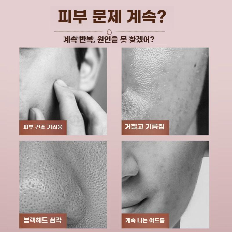 얼굴 스팀기 페이스 보습 미스트 피부 관리 페이셜 스티머 - 상세 이미지 5