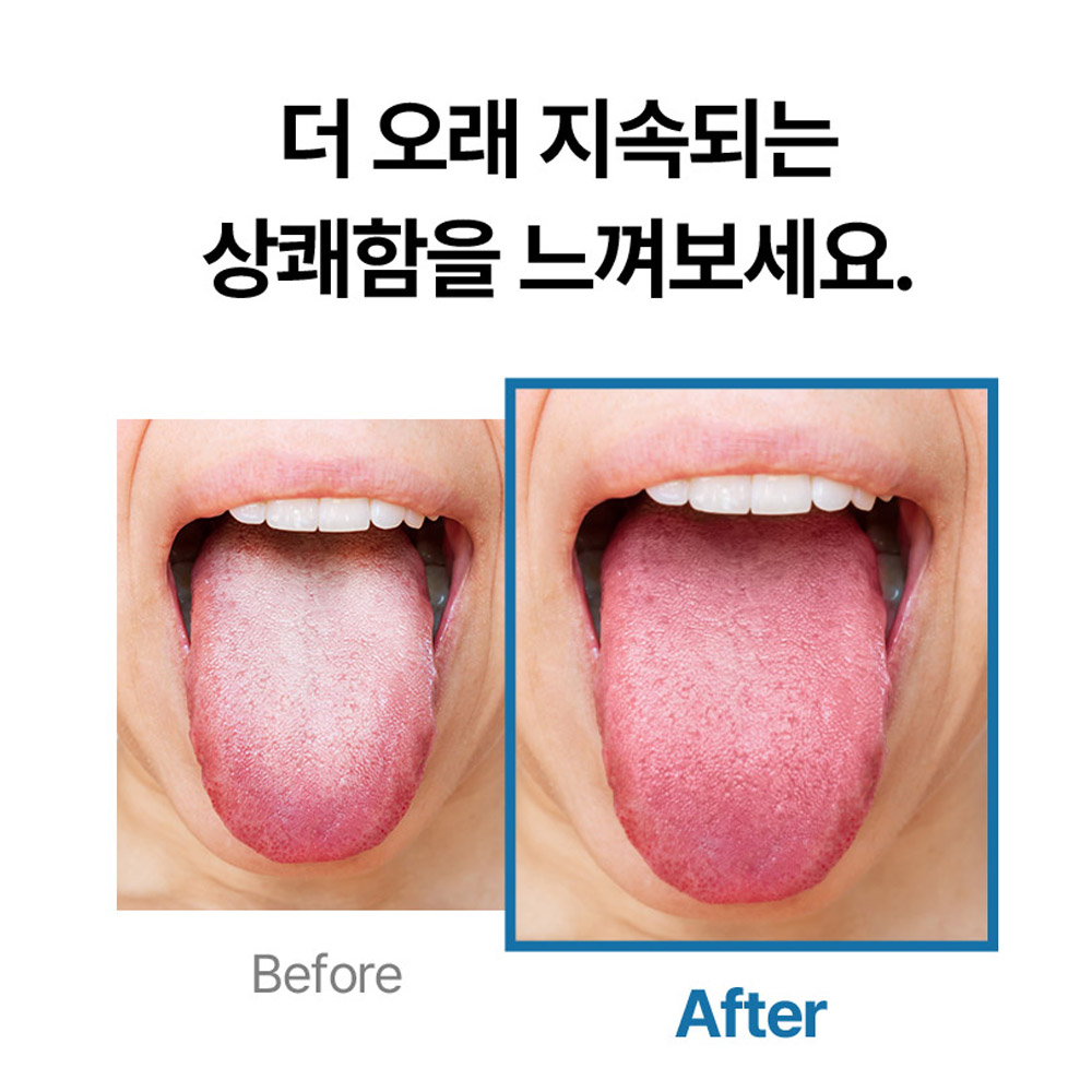 약국입점 의약외품 덴탈비 오라클린젤 대용량 250ml 구강청결 입냄새제거 충치예방 상쾌한 구취관리 클린액 - 상세 이미지 2