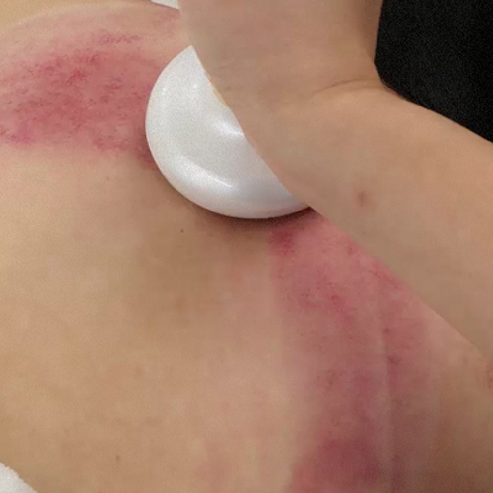 장미화의 엑스킹 EMS 진공 흡입 온열 마사지기 세트 부항 무선 괄사 저주파 에스테틱 바디 이미지 6