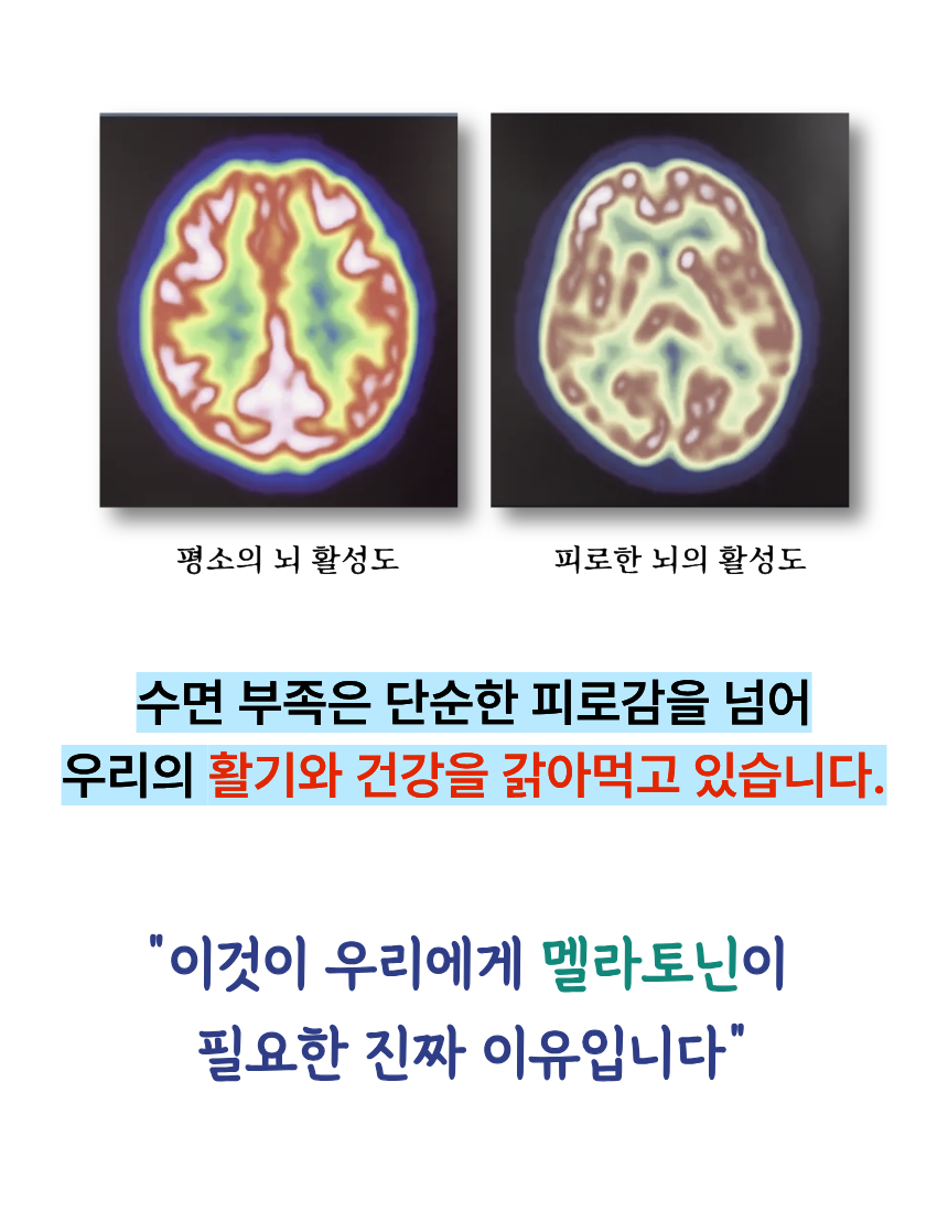 엑사멜라 식물성 멜라토닌 편안한밤 효과 효능 잠 잘오는 보조제 숙면 2mg 30정, 1개 이미지 3