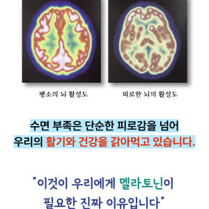 엑사멜라 식물성 멜라토닌 편안한밤 효과 효능 잠 잘오는 보조제 숙면 2m... 맛있게 먹은 솔직 후기 - 상품 이미지 3