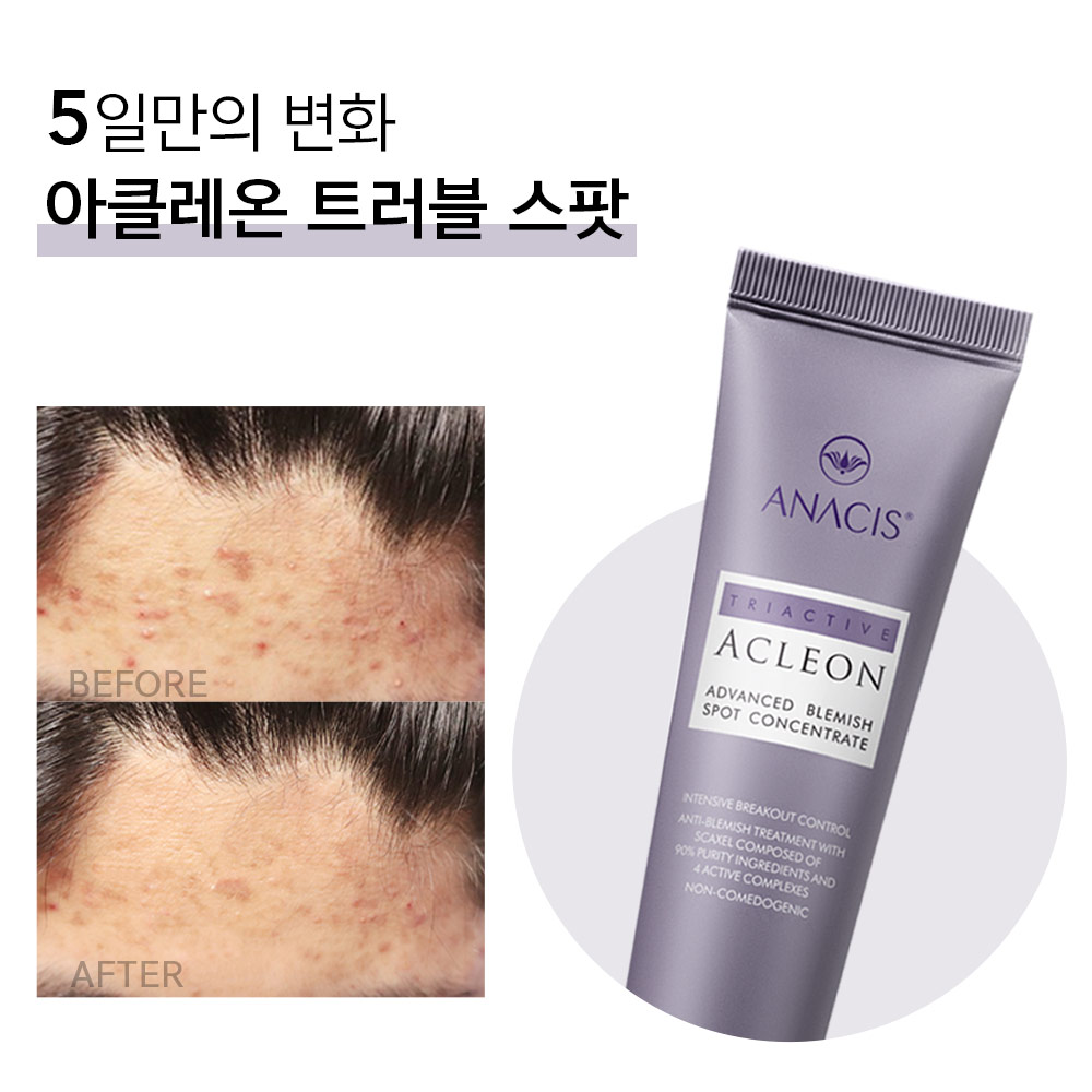 아클레온 센텔라드레싱파우더 티트리 염증 여드름 스팟 젤 30ml 여드름 빨간 붉은 자국 - 상세 이미지 5
