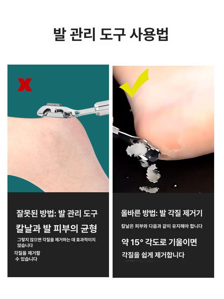 발 각질 제거 패디나이프 굳은살 케어 페디큐어 발뒤꿈치 관리 컬러풀 우드 발톱 10개 - 상세 이미지 5