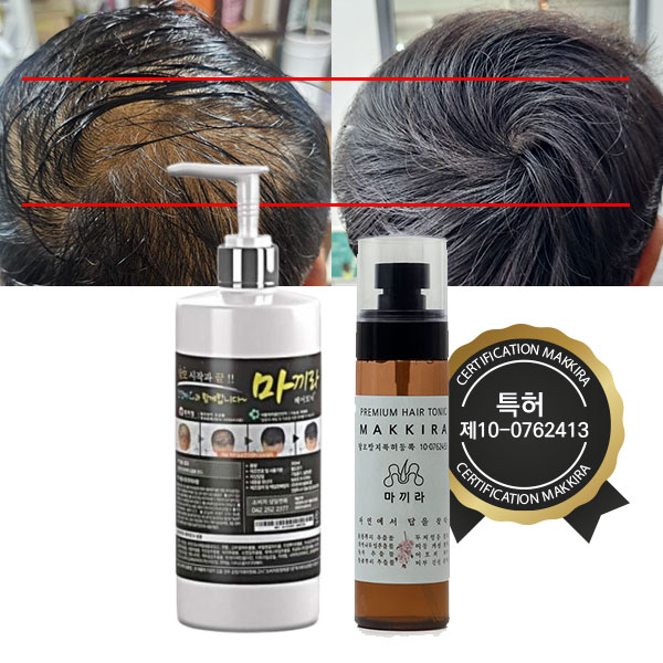 마끼라 탈모 두피 헤어토닉 각질케어 영양 보습 남성 비듬 쿨링 두피염 300ml, 1개 - 상세 이미지 2