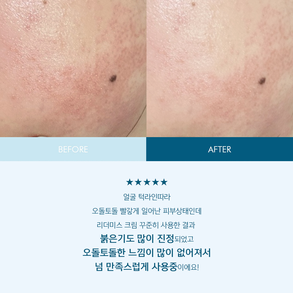 리더미스 얼굴 피부 가려움 판테놀 세라마이드 피부장벽 병풀 MD 재생 크림 150g 이미지 2