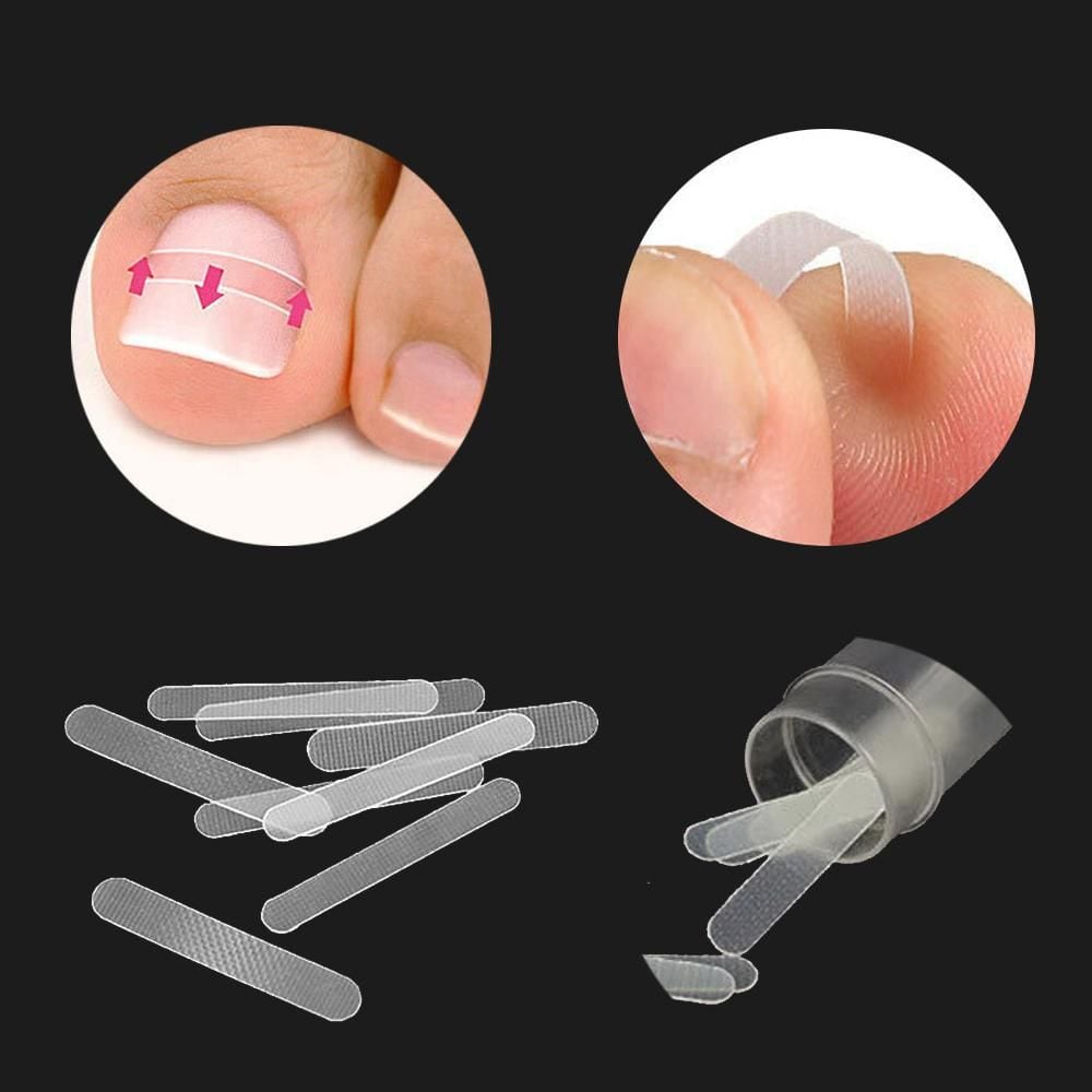네일케어 불편 성장 발톱 관리 케어 팁 10개 발톱 케어팁 10pcs - 메인 이미지
