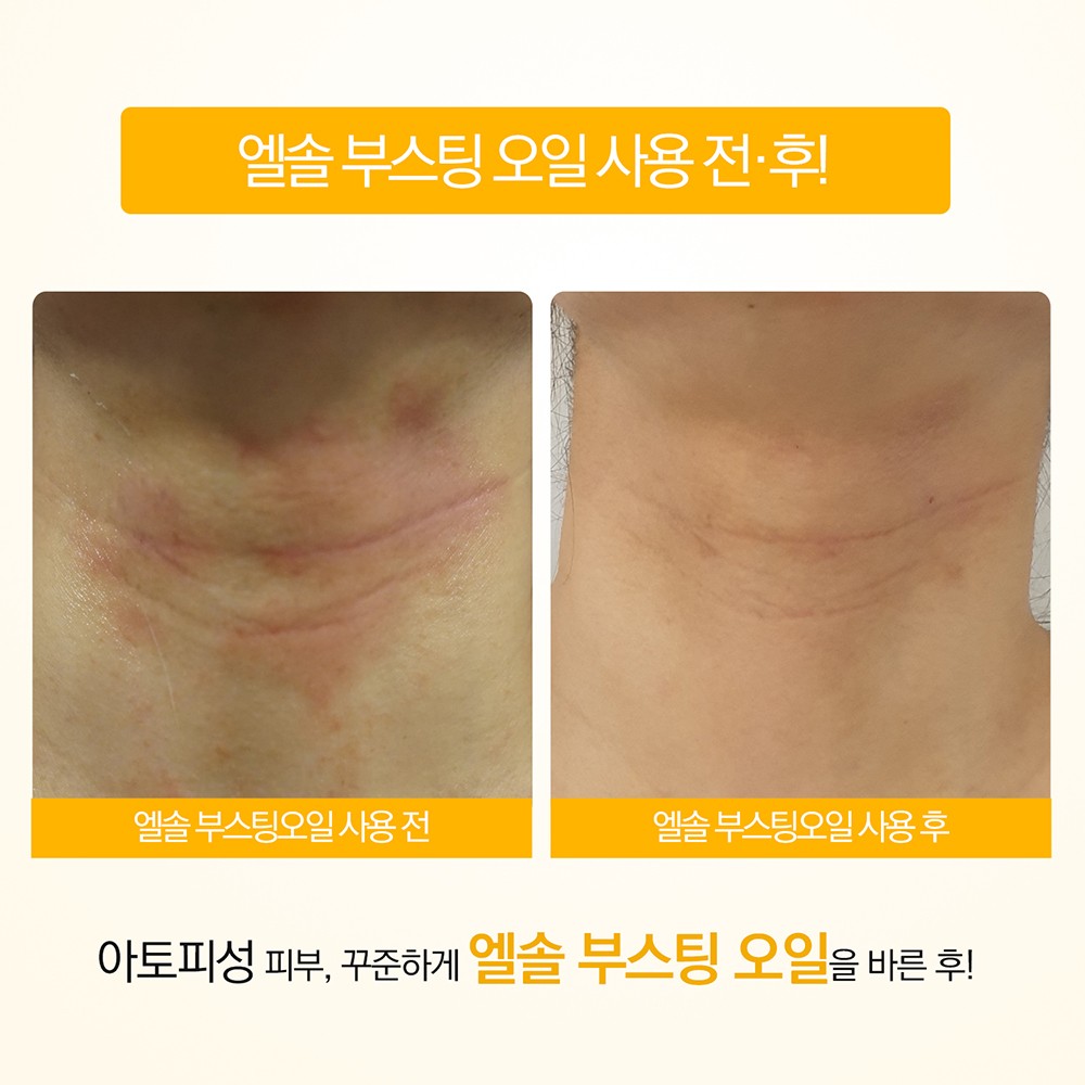 상떼 호호바오일 엘솔 부스팅 50ml 유기농 임산부 아기 이미지 8