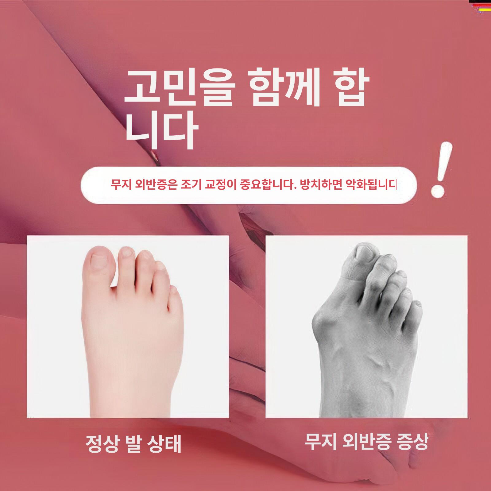 무지외반 발가락 교정기 보호대 엄지보호 스트랩 보조기 남녀공용 단품 - 상세 이미지 2