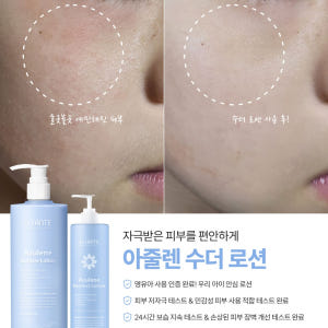 상떼 아줄렌 수더 로션 500ml+200ml 영유아 온가족 민감피부 솔직 후기 | 피부 타입별 분석 - 상품 이미지 4