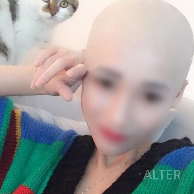 대머리 가발 무대 촬영 분장 민머리 라텍스 소품 방송 가짜헤어 공연 소형 세트 - 상세 이미지 2
