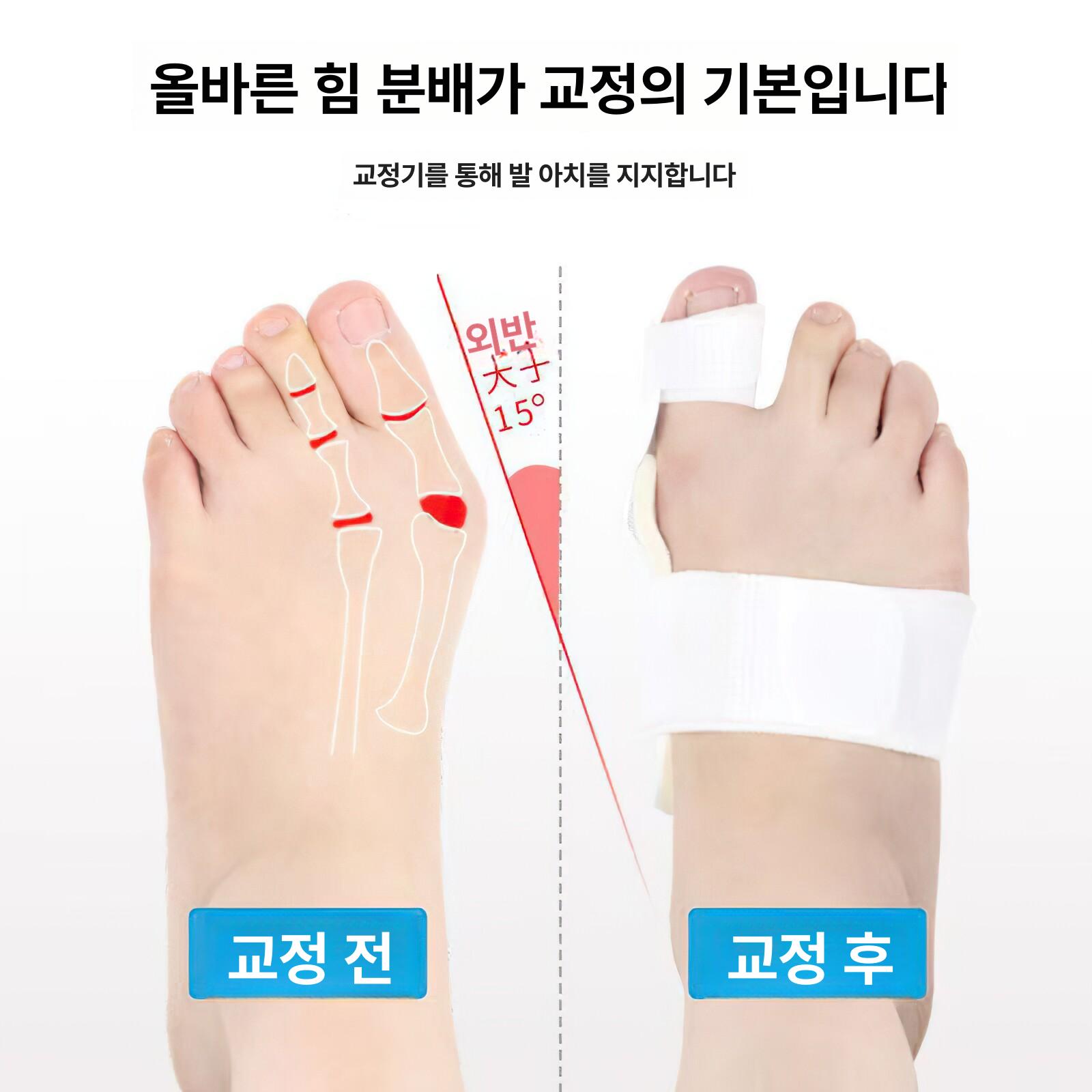 무지외반 발가락 교정기 보호대 엄지보호 스트랩 보조기 남녀공용 단품 - 상세 이미지 3