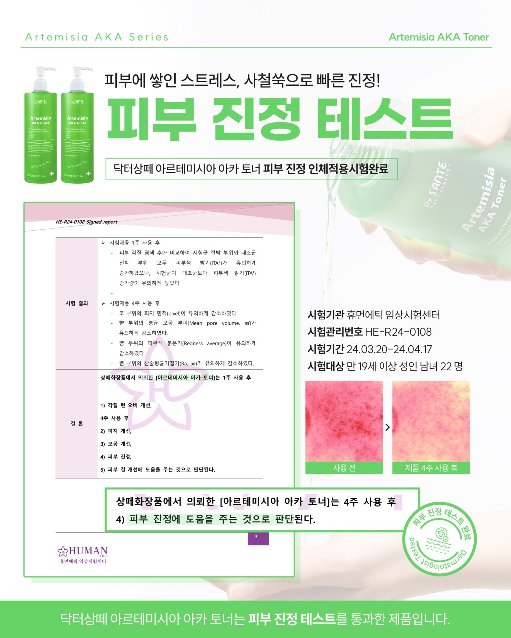 상떼 아카토너 아르테미시아 500ml 모공 약산성 여드름 - 상세 이미지 4