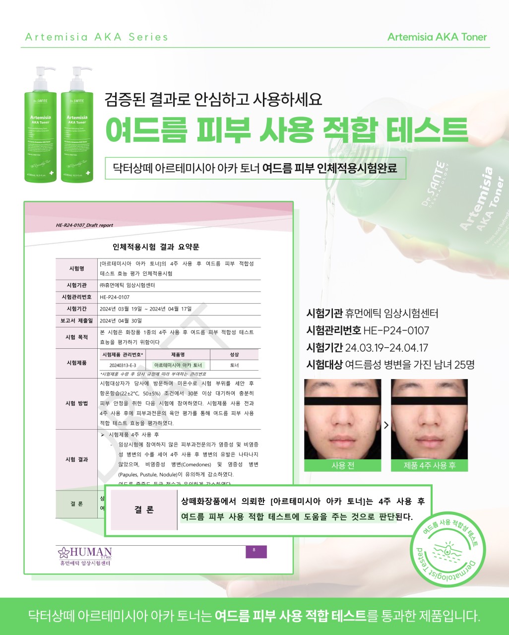 상떼 아카토너 아르테미시아 500ml 모공 약산성 여드름 이미지 8