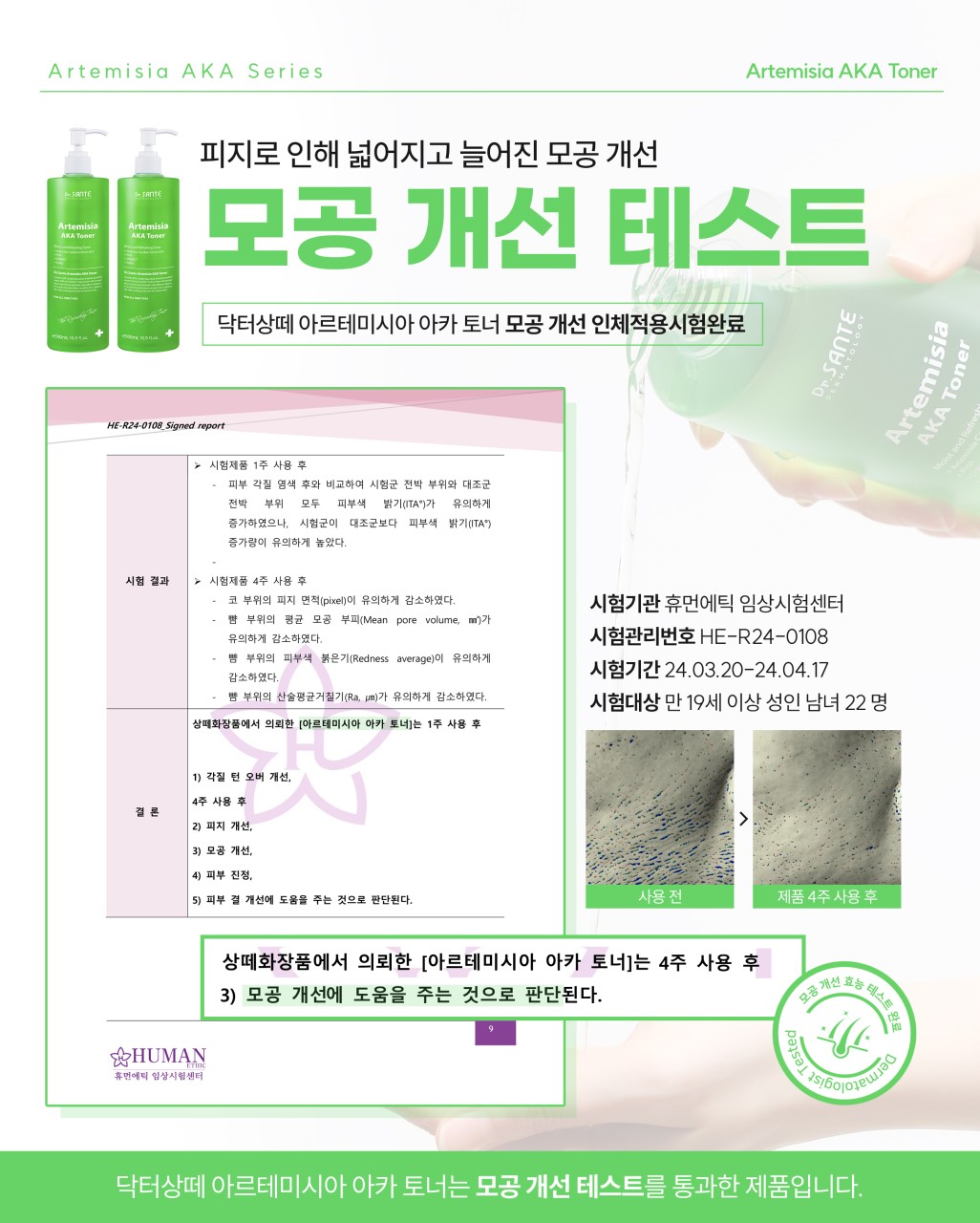 상떼 아카토너 아르테미시아 500ml 모공 약산성 여드름 - 상세 이미지 5