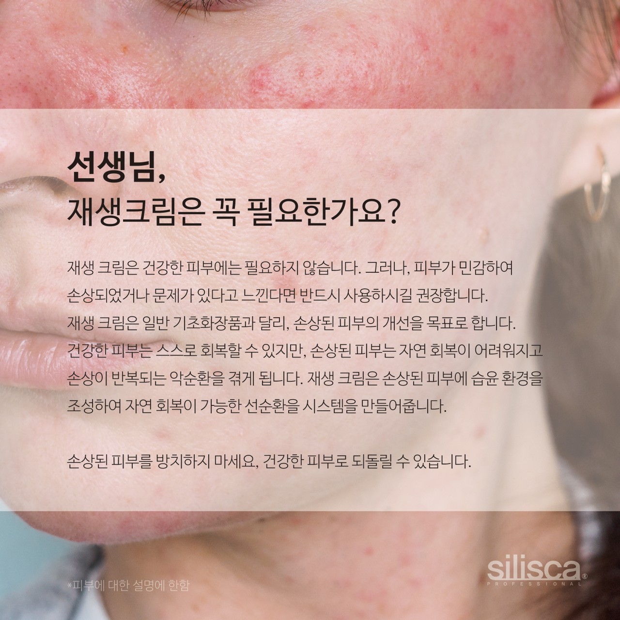 실리스카 시카트리스 오인트먼트 40g 크림 수분 진정 물광 이미지 6