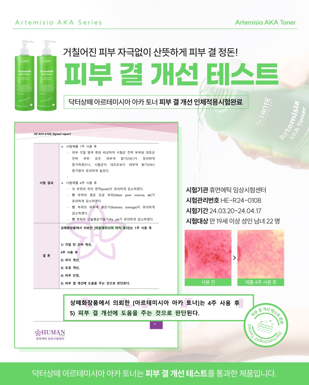 상떼 아카토너 아르테미시아 500ml 모공 약산성 여드름 - 상세 이미지 3