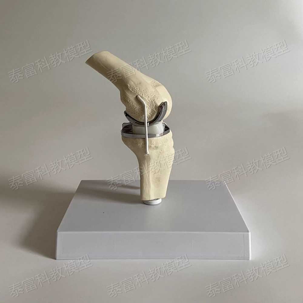 무릎관절 모형 해부학 무릅 교육 골격 뼈대 병원 모양 부분형 - 상세 이미지 3