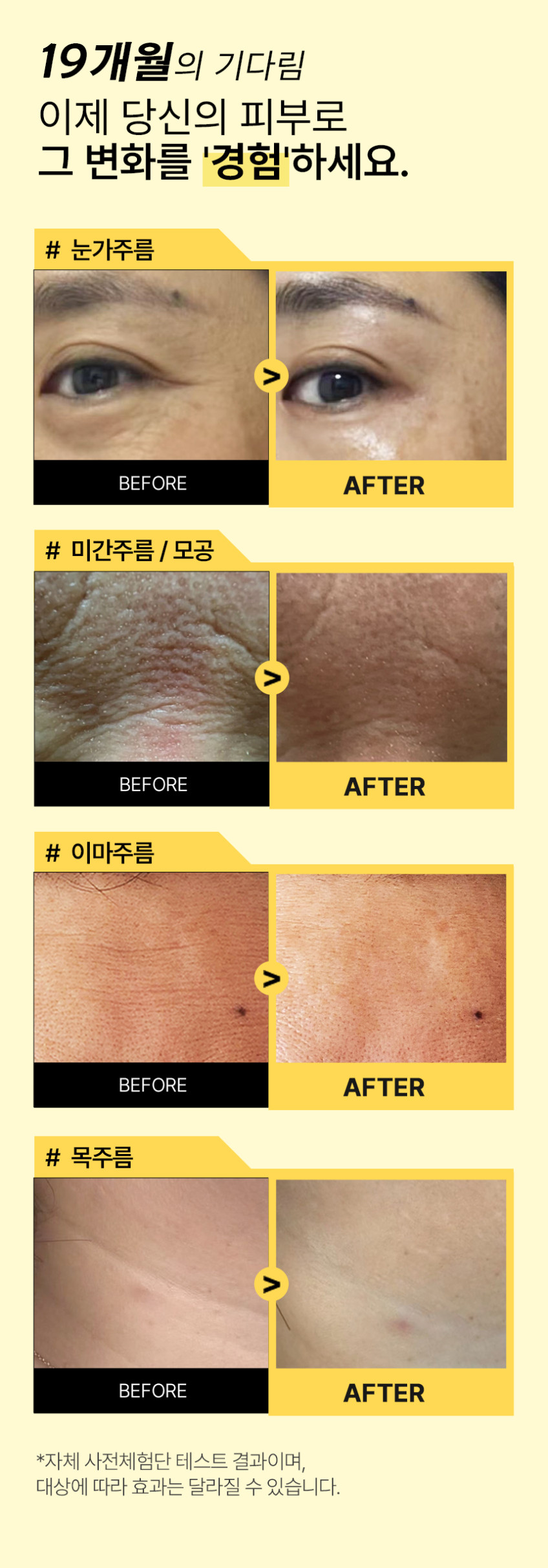 퓨어케이 레티날 0.1% 주름 탄력 모공 여드름트러블 미백 LNP 크림 20ml, 2개 판매처 상세 정보 이미지 2