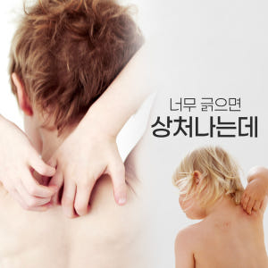 퀘르세틴 케르세틴 18000mg 브로멜라인 2박스 60포(8주분) 맛있게 먹은 솔직 후기 - 상품 이미지 3