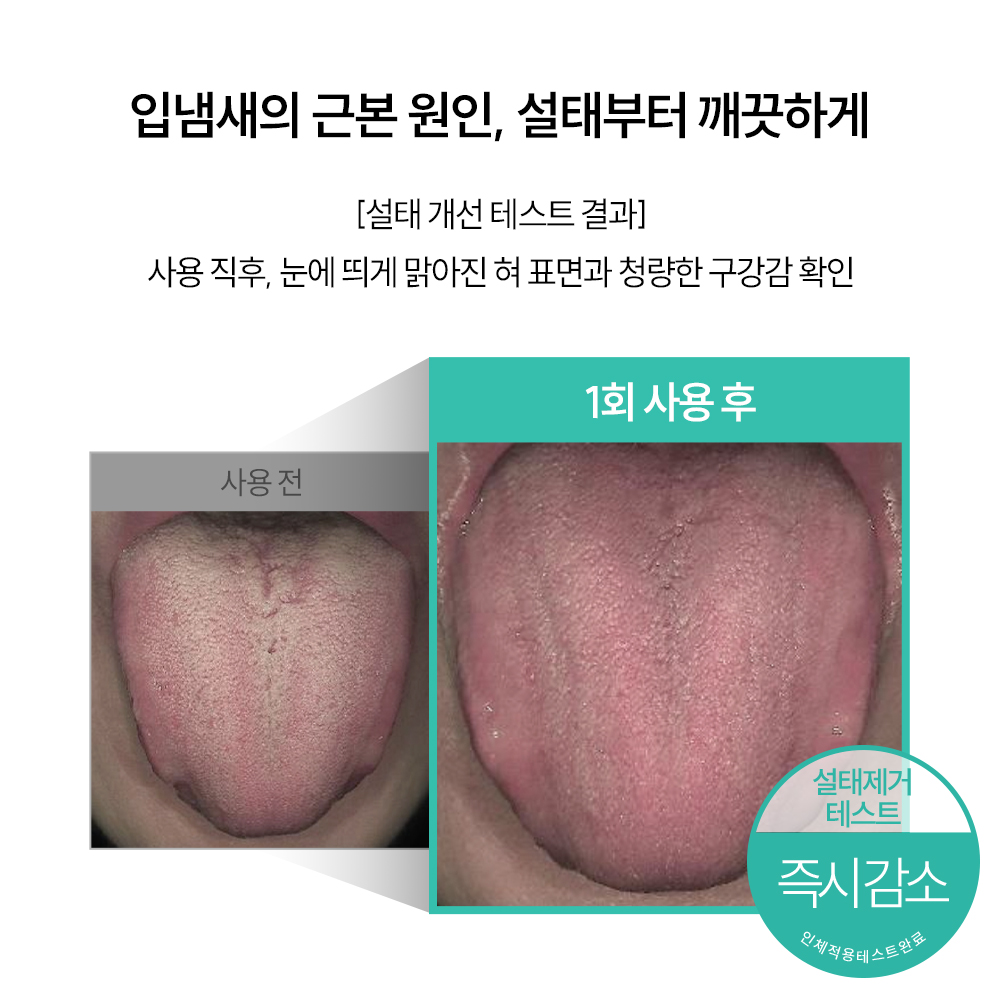지그비 고불소 고농축 자일리톨 박하선 치약 입냄새 제거 설태 바카민트향 117g, 1개 이미지 7