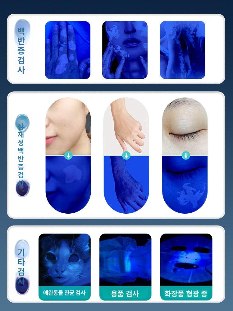 반려묘 곰팡이균 진단 우드 램프 피부 감지기 - 상세 이미지 5